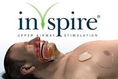 Inspire Medical Systems Inc. ()  $40M
