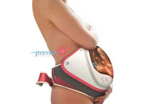 Устройство PreVue позволит будущим мамам наблюдать за их малышами Устройство PreVue позволит будущим мамам наблюдать за их малышами